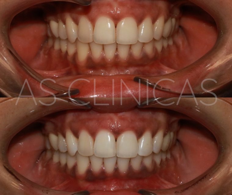 Periodontologia Caso As Cl Nicas