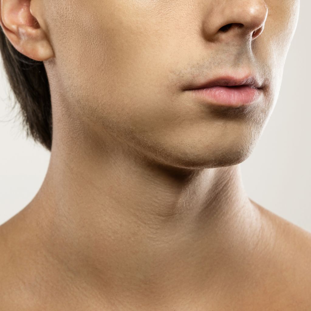 Mitras Estética - Preenchimento Facial Contorno Mandibular